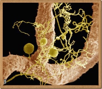 mycorrhizae_on_a_soybean_root-spl1