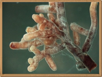 Mycorrhizal_root_tips_(amanita)